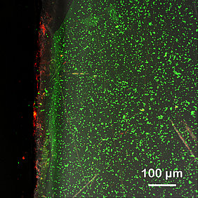 Biofilm auf einem Aufwuchsträger aus Acrylglas 24 h nach Einbringung in den Biogasreaktor (37°C). Rot: Gesamtheit aller Bacteria/Archaea, grün: Extrazelluläre, polymere Substanzen bilden die schleimige Matrix des Biofilms.
